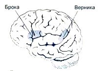 Афазия