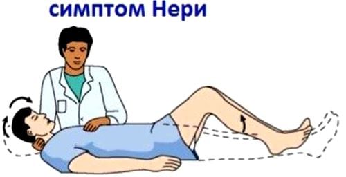 Остеохондроз позвоночника с корешковым синдромом в грудном отделах
